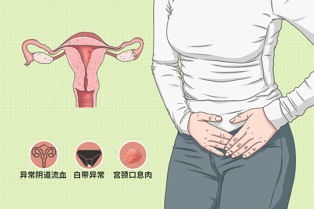 子宫息肉直径1.5会影响试管怀孕吗,试管中内膜息肉影响成功率吗