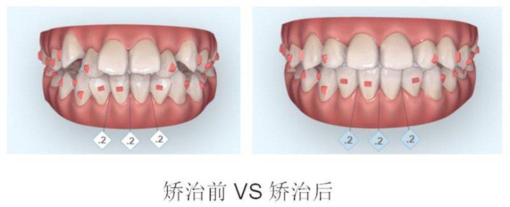 儿童医院口腔科看牙,看牙医小朋友哭了