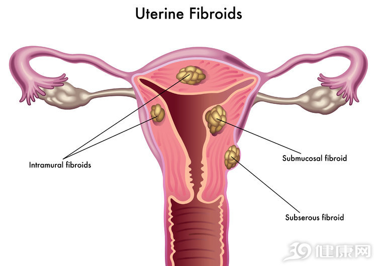 医生不建议补雌二醇,医生说雌激素过高什么意思