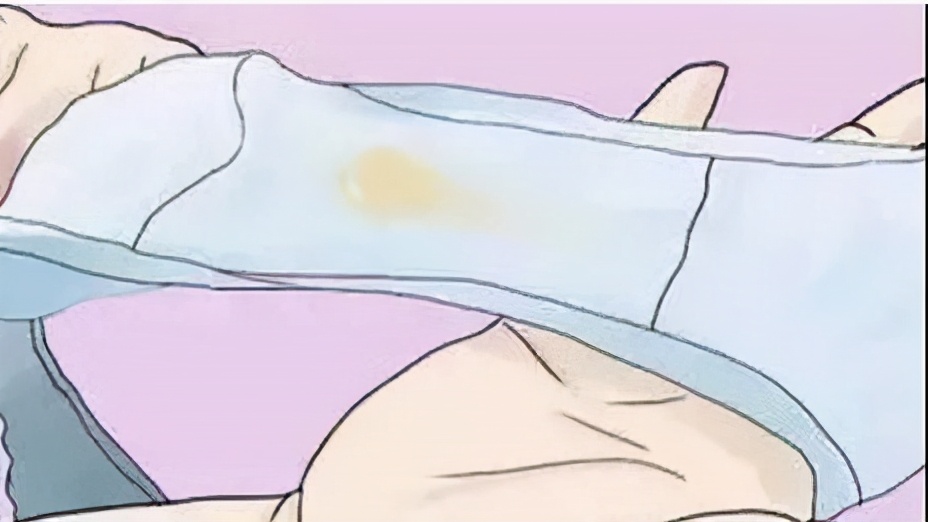 “妇科健康的晴雨表”你真的会看吗？