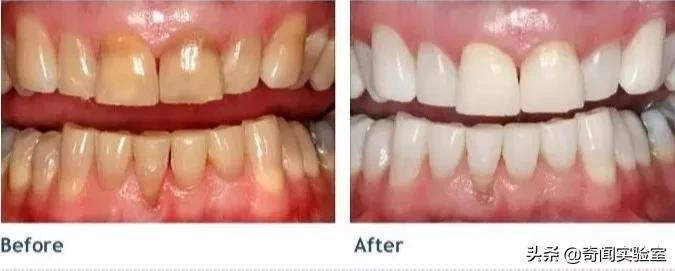 专治牙黄口臭的小窍门,牙黄口臭用什么牌子牙膏刷牙最好