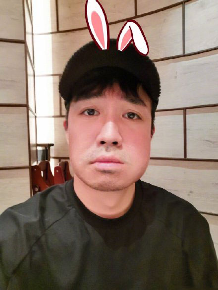 俞灏明的脸能修复吗,俞灏明的脸怎么修复的