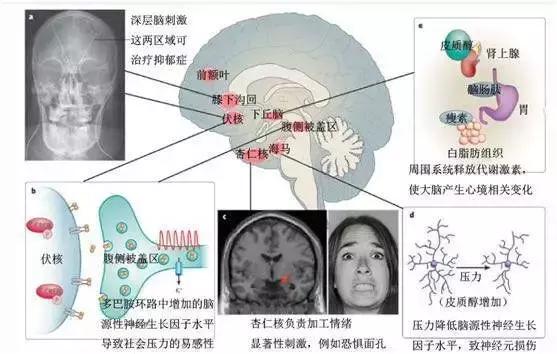 一个抑郁症患者的自救电影,一个重度抑郁症患者的自我救赎