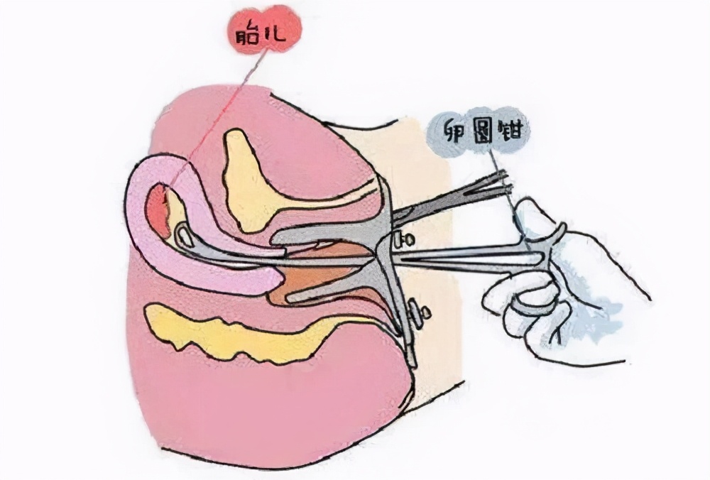 子宫后位怀孕要关注什么问题,子宫后位怀孕有影响吗