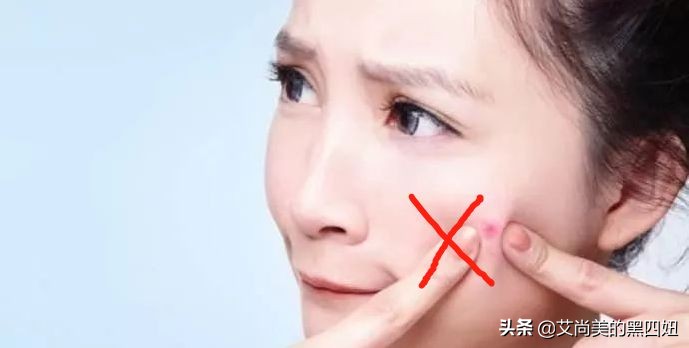 嘴巴周围老是反复长痘已经半年了,47岁嘴周围反复长痘什么原因