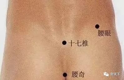 八髎穴位针灸可以治疗痛经,痛经针灸特效穴位