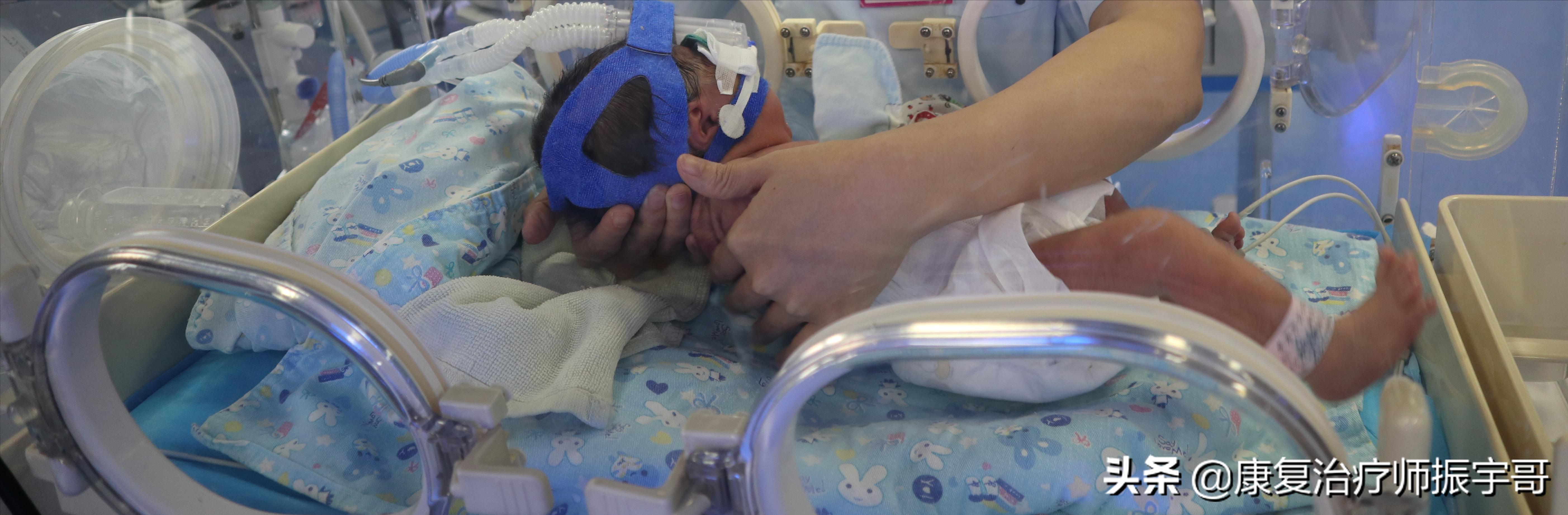 科普脑瘫患儿的家庭康复训练方法,能力很低的脑瘫儿如何做康复