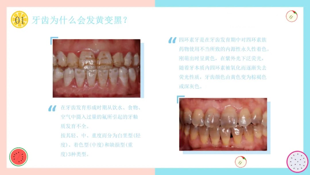 柠檬治牙白,柠檬美白牙齿正确方法