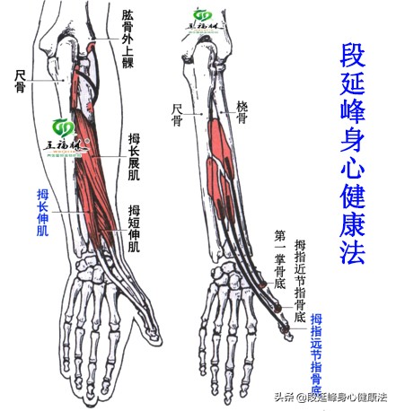 拇指缩短性腱鞘炎,拇指腱鞘炎屈伸不利
