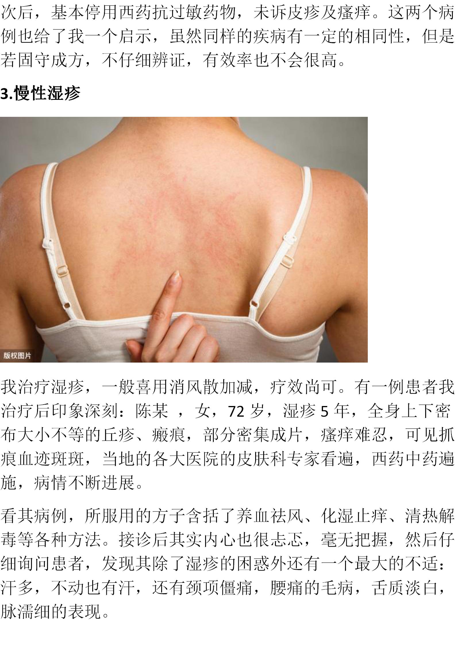 倪师治皮肤病的经方有几个,寒湿皮肤病倪海厦用什么经方