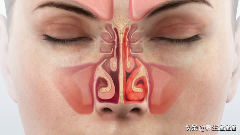 儿童过敏性鼻炎按什么穴位有效,按哪个穴位可以治疗过敏性鼻炎