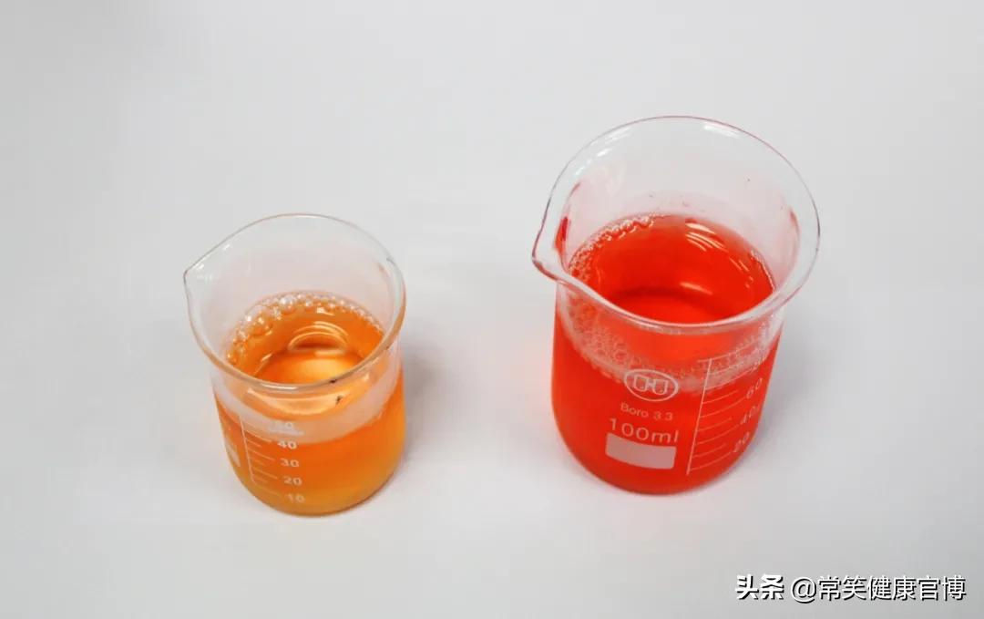 尿液淡黄色和深黄色的对比,尿液黄色和淡黄色的区别