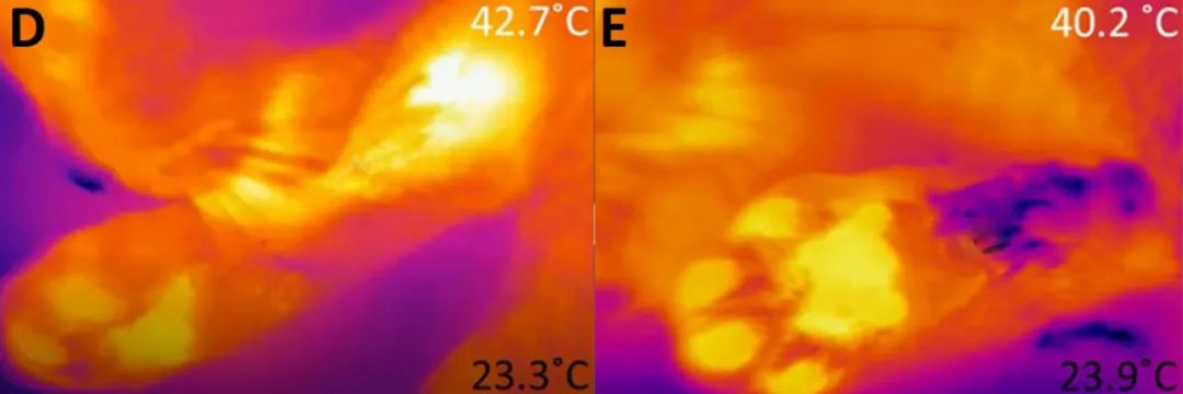孩子膀胱容量130,儿童最大膀胱容量197正常吗