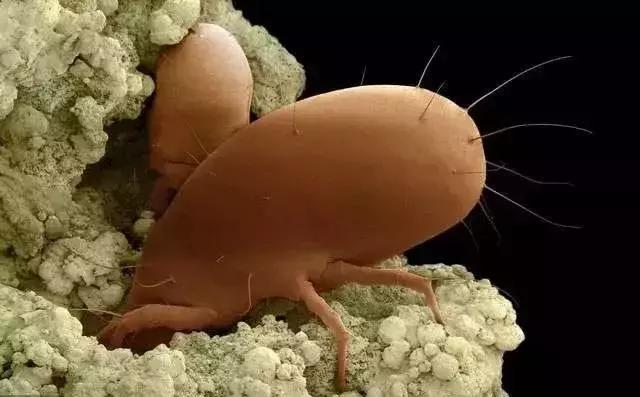 螨虫把皮肤毛孔弄得越来越大,脸上反反复复长螨虫毛孔还大