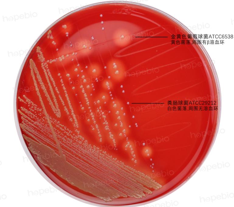 细菌溶血现象的原理,细菌革兰染色实验报告