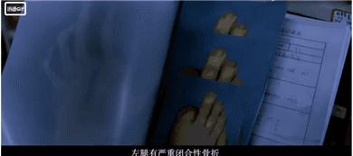 法医秦明删减片段,法医秦明1高清无删减版在线观看