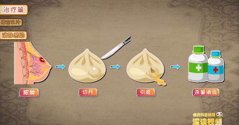 乳腺炎期间能通乳吗,非哺乳期乳腺炎要热敷还是冷敷