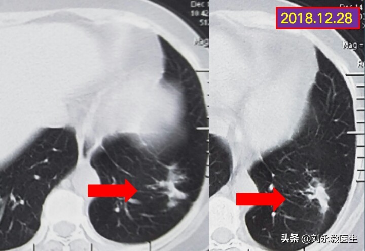 癌症的治疗有意义吗,卖房子治疗癌症有意义吗