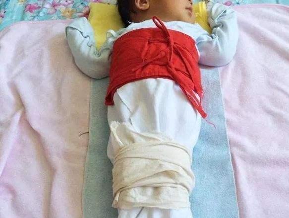 孩子腿型可以矫正吗,宝宝腿会天生畸形吗