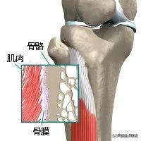伤害了1/3跑者的胫骨炎，请务必重视起来