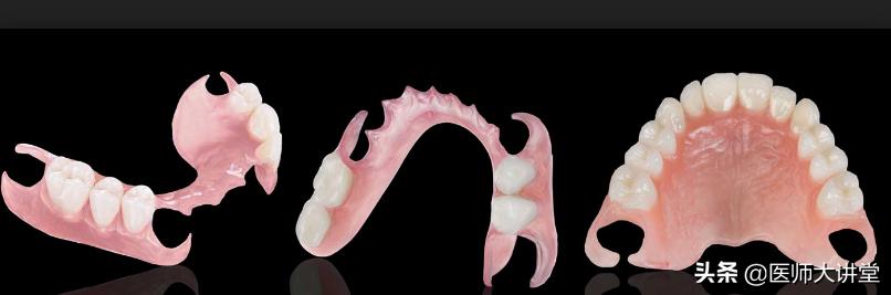 活动假牙排牙制作,下牙义齿制作