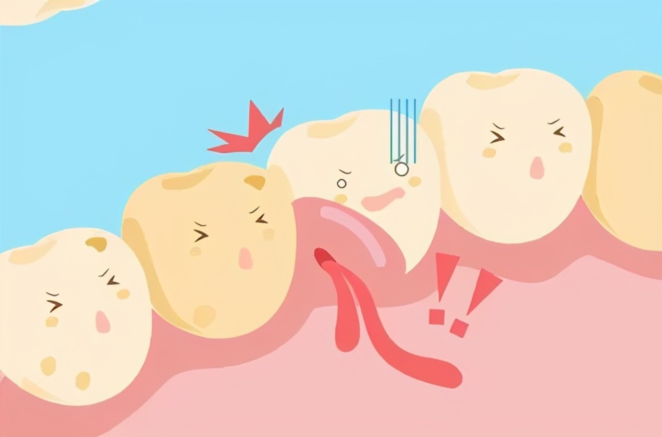 怀孕期间能种植牙齿吗,孕妇种牙还是戴牙套