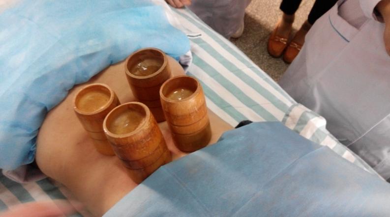 拔竹罐减肥有效吗,拔竹罐能减肥吗有效果吗