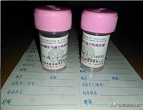 医生做胃镜检查时会看食道的吗,胃镜检查全过程视频消化内科检查