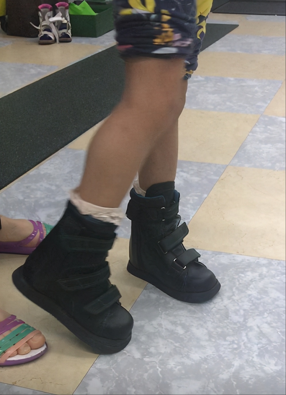 孩子足外翻买什么鞋矫正,儿童足外翻矫正鞋去哪里做