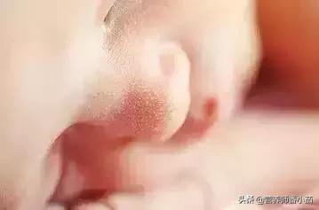 粟粒疹宝宝,宝宝红斑丘疹鉴别图谱