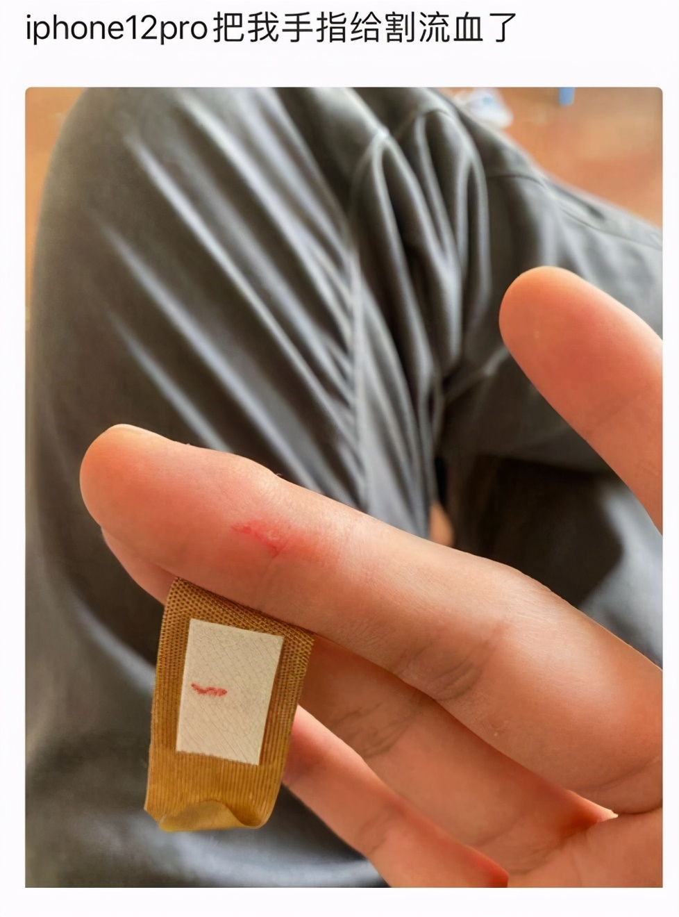 泰国一男子因被iphone12手机割破手指发帖惹果粉怒怼