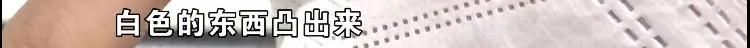 鼻子突然变暗变红,想要鼻子变高的方法