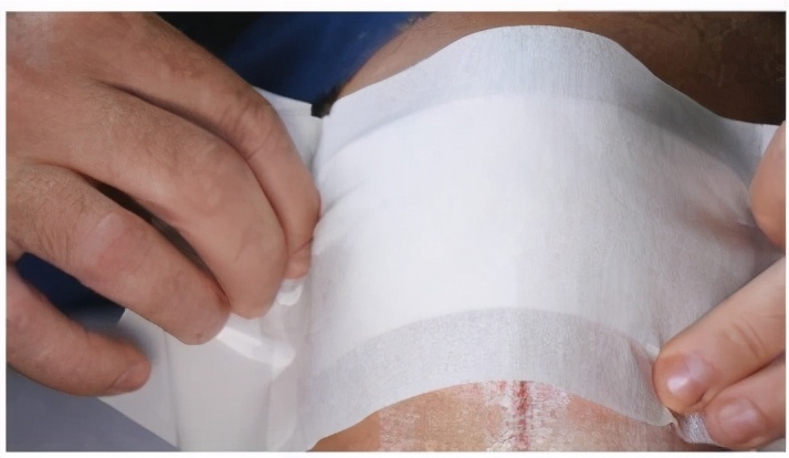 皮肤擦伤有渗出液,皮肤擦伤涂什么药