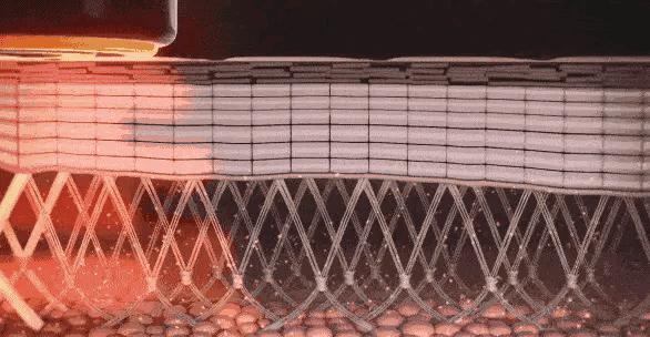 美容针美容的误区,为美而整容最后付出的代价