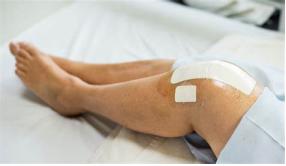 膝关节置换后肿胀可用盐袋热敷吗,膝关节置换50天仍然肿胀吃什么药