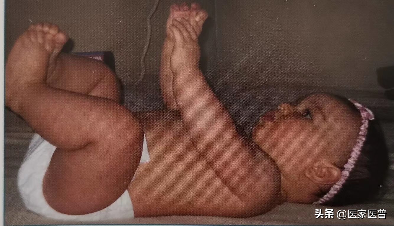 产后科普视频,产后科普之产后腰痛