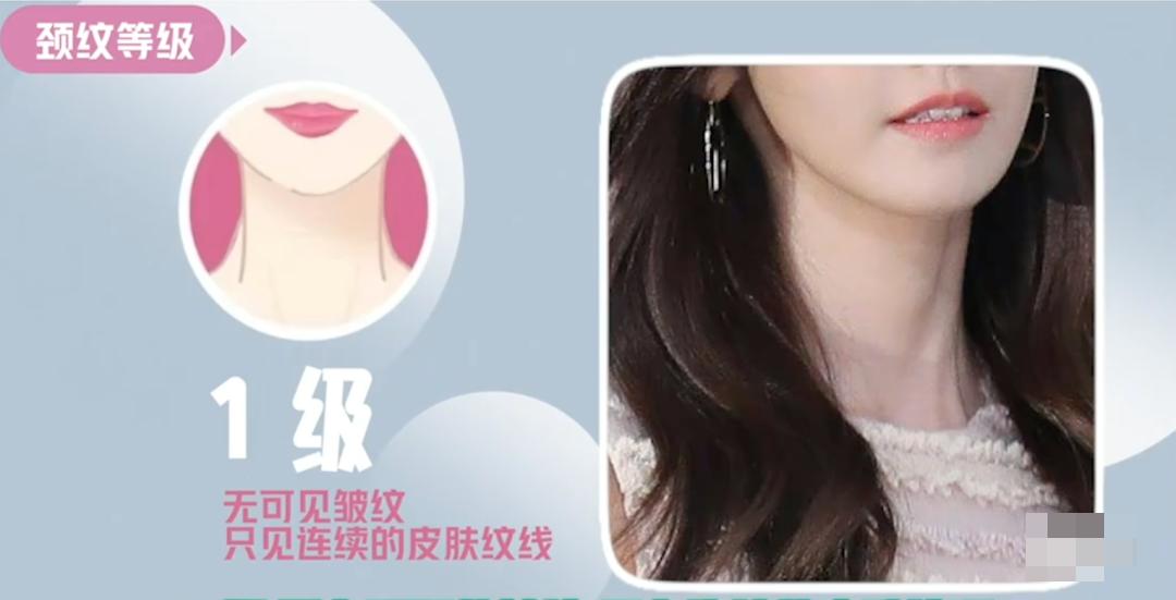 嗨体颈纹针使用方法,嗨体颈纹注射全过程