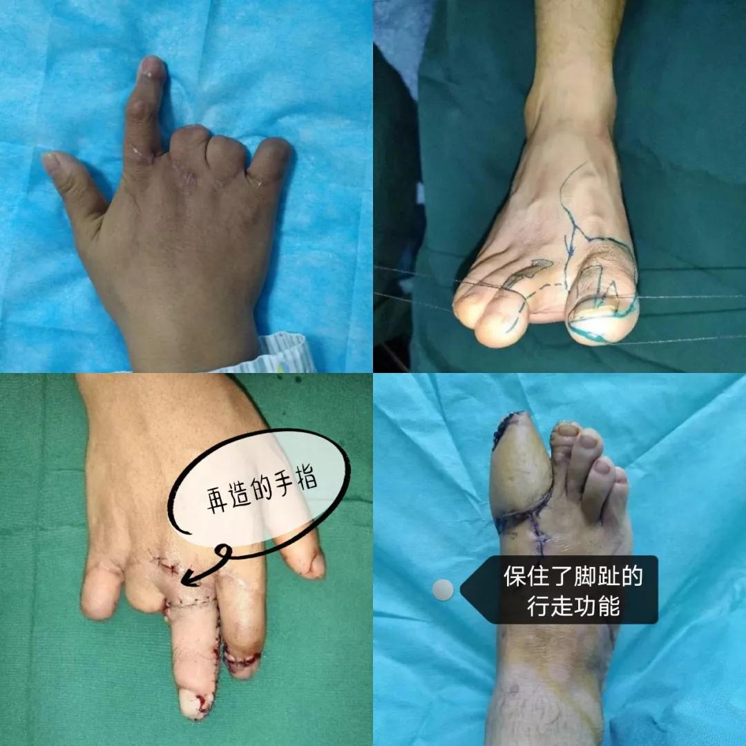 杨晓荣：酷爱钻研专挑“硬骨头”啃的学科带头人