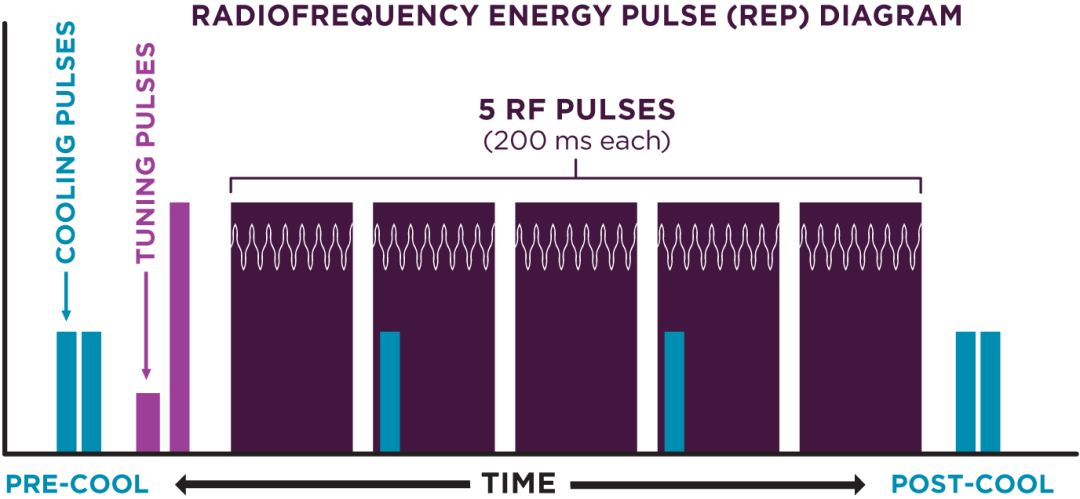 热玛吉第五代原理及讲解,第五代热玛吉的优缺点