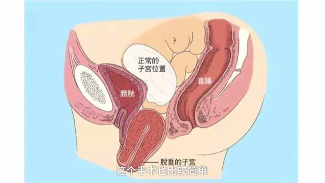 三个妈妈里，就有一个尿*禁失**
