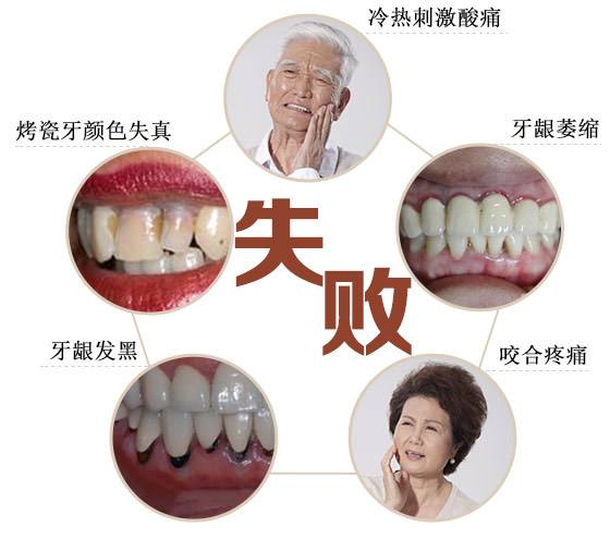 我的烤瓷牙为什么那么厚,我的烤瓷牙脱落怎么办