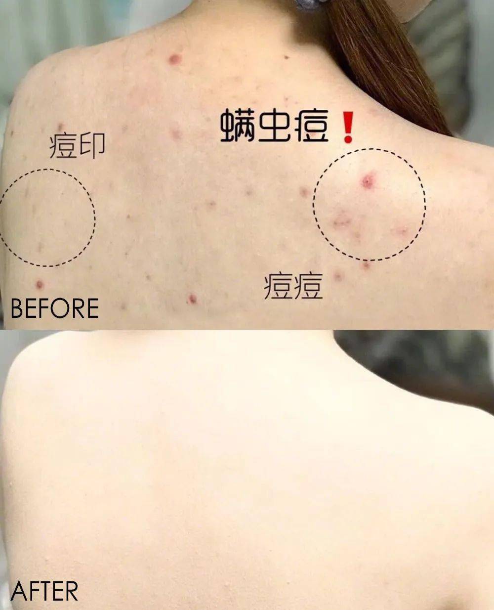 英国珀婷pertine除螨喷雾剂,瑞士珀婷pertine除螨喷雾剂