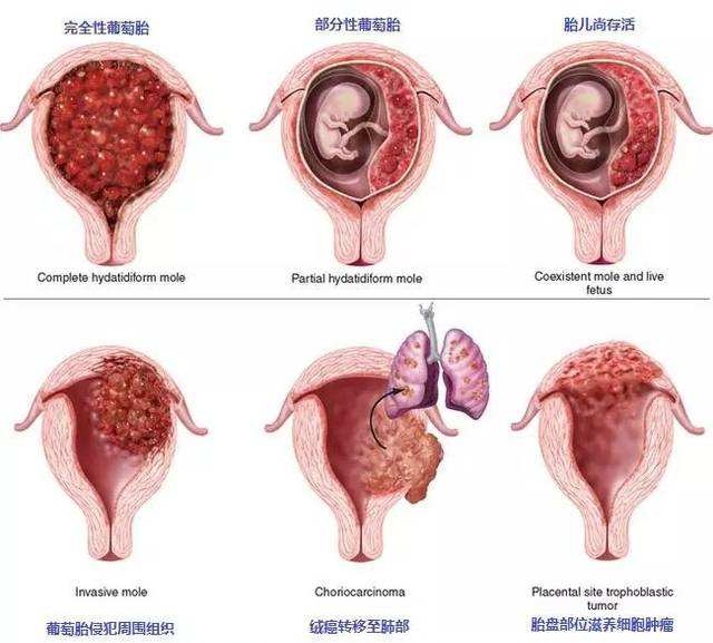 李女士隐瞒怀孕,李女士假怀孕