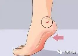 国外被狗咬了打狂犬疫苗吗知乎,外国被狗咬为啥不给打狂犬疫苗