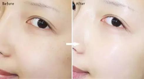 8款最好用护肤品推荐,价格亲民又特别好用的精华