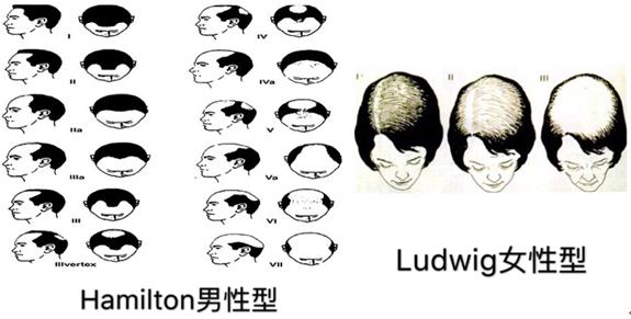 如何挽救脱发,父亲脱发怎么挽救