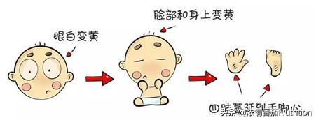 一月龄宝宝养育要点,猛涨期宝宝喂养方法