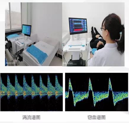 心脑血管微循环检测仪器,心脑血管检查仪