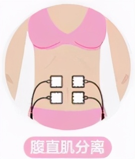 三指半到闭合，一个双胞胎妈妈的腹直肌康复之路