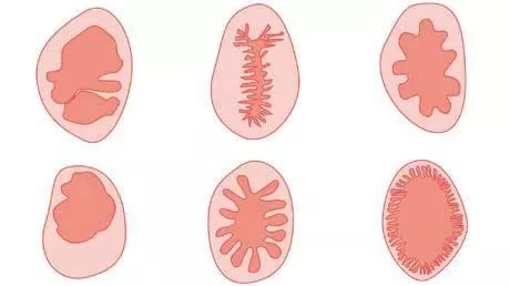 3岁女孩得了阴道炎！保护好小公举，医生教你六招